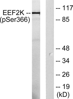 eEF2K (phospho Ser366) rabbit pAb Antibody