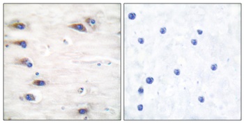 Ksr-1 (phospho Ser392) rabbit pAb Antibody
