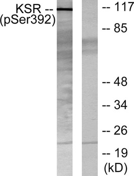 Ksr-1 (phospho Ser392) rabbit pAb Antibody