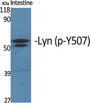 Lyn (phospho Tyr508) rabbit pAb Antibody