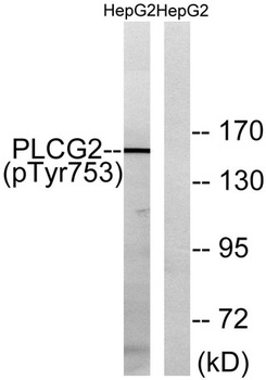 PLC γ2 (phospho Tyr753) rabbit pAb Antibody