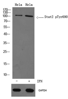 Stat2 (phospho Tyr690) rabbit pAb Antibody