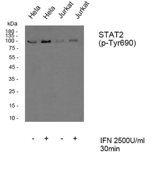 Stat2 (phospho Tyr690) rabbit pAb Antibody