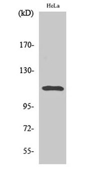 Stat2 (phospho Tyr690) rabbit pAb Antibody