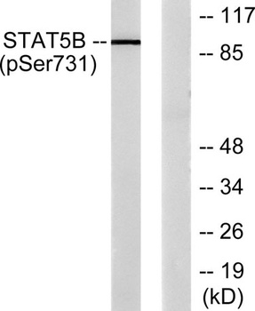 Stat5 (phospho Ser726/731) rabbit pAb Antibody