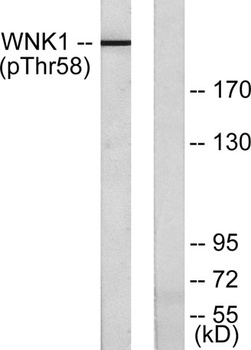 WNK1 (phospho Thr60) rabbit pAb Antibody