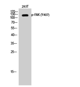 FAK (phospho Tyr407) rabbit pAb Antibody
