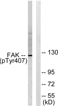 FAK (phospho Tyr407) rabbit pAb Antibody