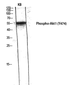 Akt1 (phospho Tyr474) rabbit pAb Antibody