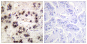 p63 (phospho Ser455) rabbit pAb Antibody