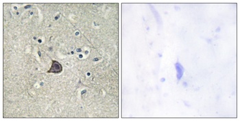 PLC β3 (phospho Ser537) rabbit pAb Antibody