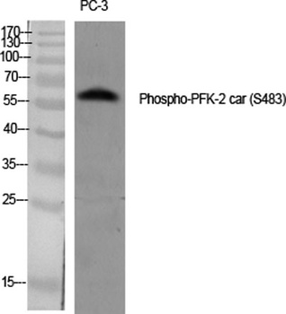 PFK-2 car (phospho Ser483) rabbit pAb