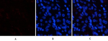 p38 (phospho Tyr323) rabbit pAb Antibody