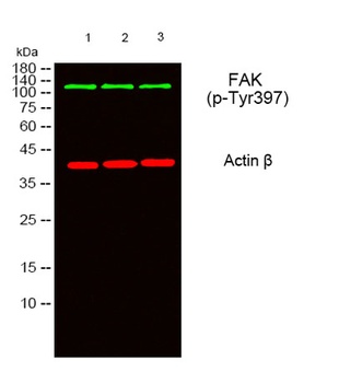FAK (phospho Tyr397) rabbit pAb Antibody