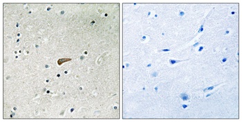FRS2 (phospho Tyr436) rabbit pAb Antibody