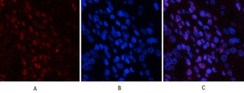 JNK1/2/3 (phospho Tyr185) rabbit pAb Antibody