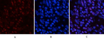 JNK1/2/3 (phospho Tyr185) rabbit pAb Antibody