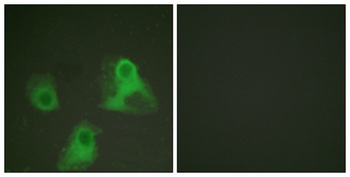 Adducin α/β (phospho Ser726/713) rabbit pAb