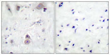 Amyloid-β (phospho Thr743) rabbit pAb Antibody