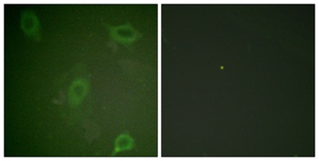 Amyloid-β (phospho Thr743) rabbit pAb Antibody