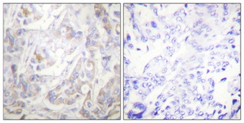 Cytokeratin 18 (phospho Ser33) rabbit pAb Antibody