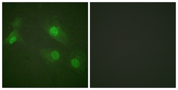 NFκB-p105 (phospho Ser927) rabbit pAb Antibody