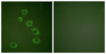 Neu (phospho Tyr1221/Y1222) rabbit pAb Antibody