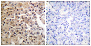 Neu (phospho Tyr1221/Y1222) rabbit pAb Antibody
