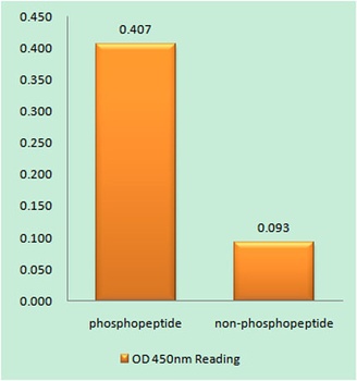 IGF-IR (phospho Tyr1161) rabbit pAb