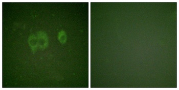 IGF-IR (phospho Tyr1161) rabbit pAb
