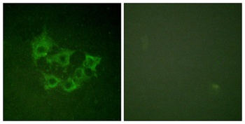 Cot (phospho Thr290) rabbit pAb Antibody