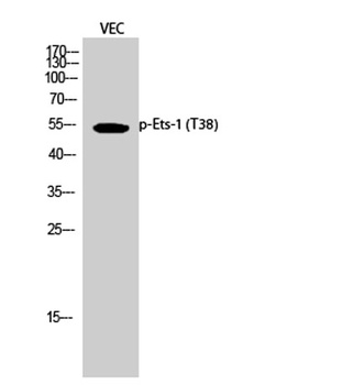 Ets-1 (phospho Thr38) rabbit pAb Antibody