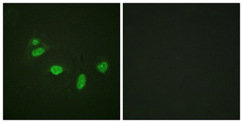 Ets-1 (phospho Thr38) rabbit pAb Antibody