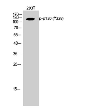 p120 (phospho Tyr228) rabbit pAb Antibody