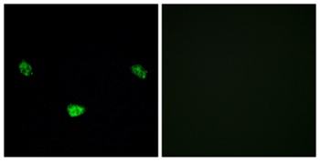 HNF4-α (phospho Ser313) rabbit pAb Antibody