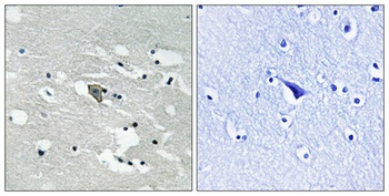 Flt-1 (phospho Tyr1048) rabbit pAb Antibody