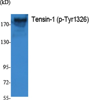 Tensin-1 (phospho Tyr1326) rabbit pAb Antibody