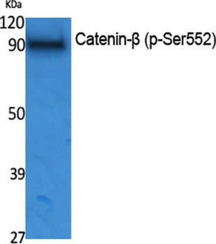 Catenin-β (phospho Ser552) rabbit pAb Antibody