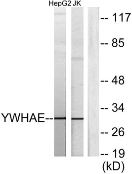 14-3-3 ε rabbit pAb Antibody