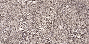 14-3-3 ε rabbit pAb Antibody