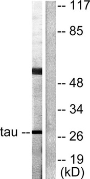 14-3-3 θ/τ rabbit pAb Antibody
