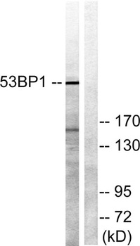 53BP1 rabbit pAb Antibody