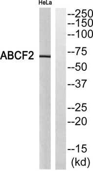 ABCF2 rabbit pAb Antibody
