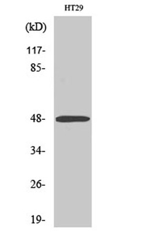 ABHD2 rabbit pAb Antibody