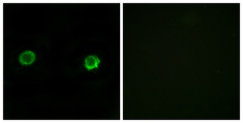 ABHD2 rabbit pAb Antibody