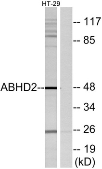 ABHD2 rabbit pAb Antibody