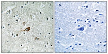 Abl1/2 rabbit pAb Antibody