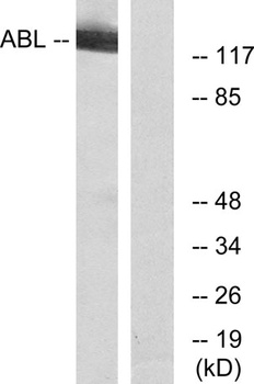 Abl1/2 rabbit pAb Antibody