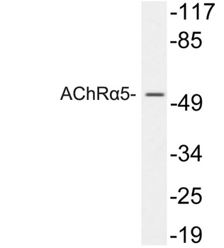 AChRα5 rabbit pAb Antibody