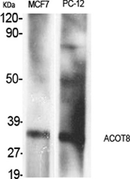 ACOT8 rabbit pAb Antibody